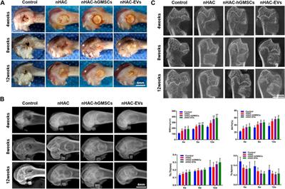 Extracellular vesicles secreted by human gingival mesenchymal stem cells promote bone regeneration in rat femoral bone defects